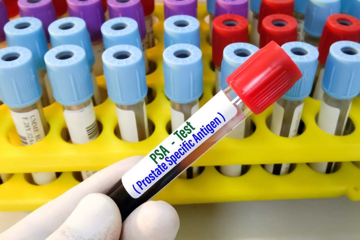 Prostate cancer and PSA testing