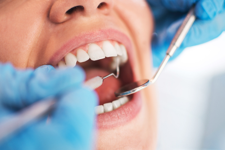 Cosmetic Dentistry: How to Set Realistic Expectations Before Your First Visit