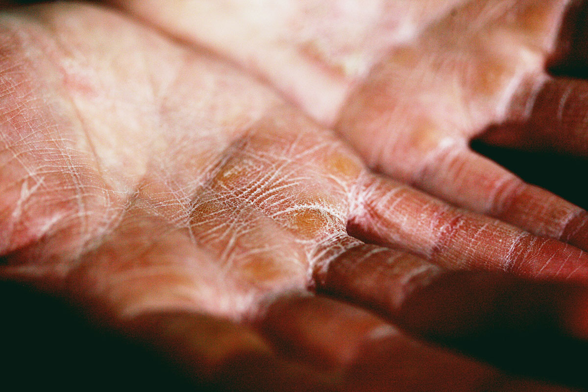 Should You Soothe Your Skin?